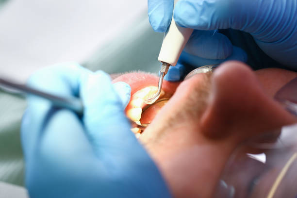 Best Emergency Dental Care for Abscessed Tooth in Semmes, AL