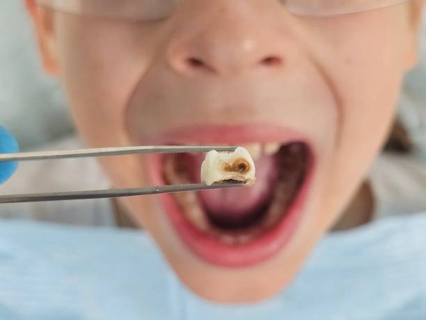 Best Pediatric Emergency Dentist in Semmes, AL